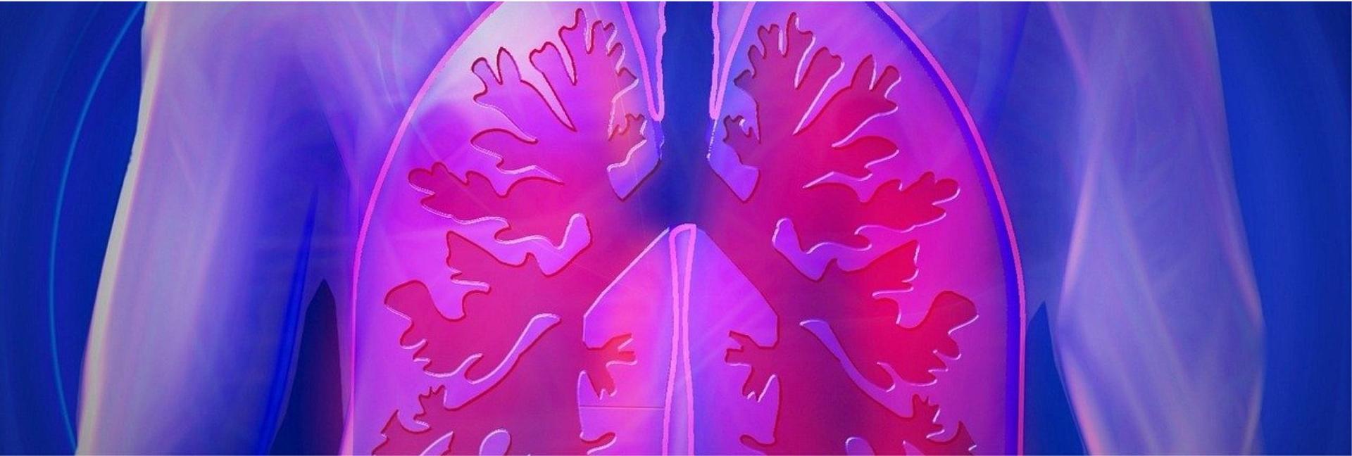 Image: Spotlight on Capmatinib, A Potential New Treatment for METex14 Advanced Non-Small Cell Lung Cancer